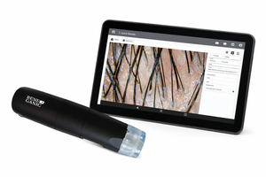 Professionelles Kopfhaut-Analysegerät – im Komplettset mit Tablet & Schulung